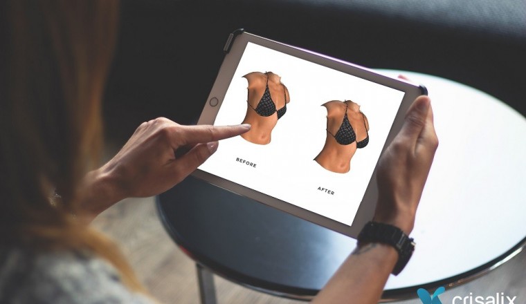 Virtual Reality Technology is Being Used to Allow Women to Preview Their Surgery before Going under the Knife